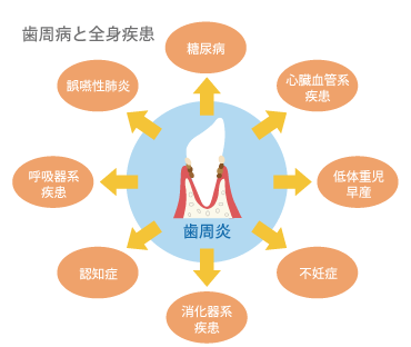 歯周病と全身疾患の図